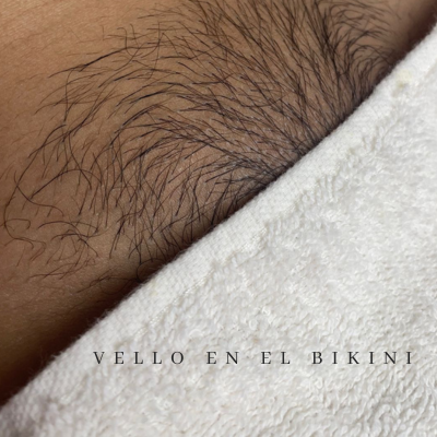 vello en el bikini